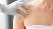 How Technology could Stop the Skin Cancer Crisis becoming a Catastrophe